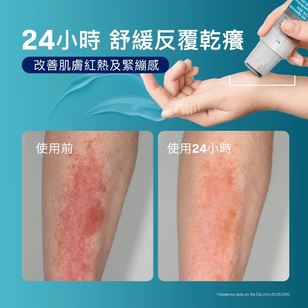 Cetaphil舒特膚 AD益膚康瞬效舒敏凝膠